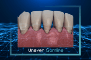 Gumline Twenty One dental clinic dentist Brighton Hove