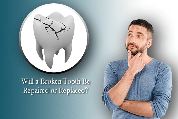 How to Fix a Cracked or Broken Tooth: Dental Studios: General and