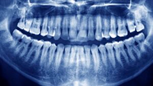 Teeth Twenty One dental clinic dentist Brighton Hove