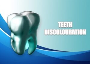 Teeth Twenty One dental clinic dentist Brighton Hove