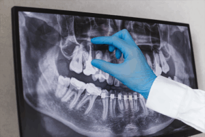 teeth Twenty One dental clinic dentist Brighton Hove