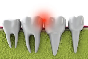 Twenty One dental clinic dentist Brighton Hove