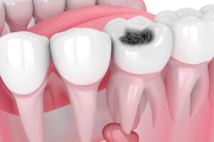 Twenty One dental clinic dentist Brighton Hove