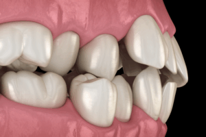Twenty One dental clinic dentist Brighton Hove