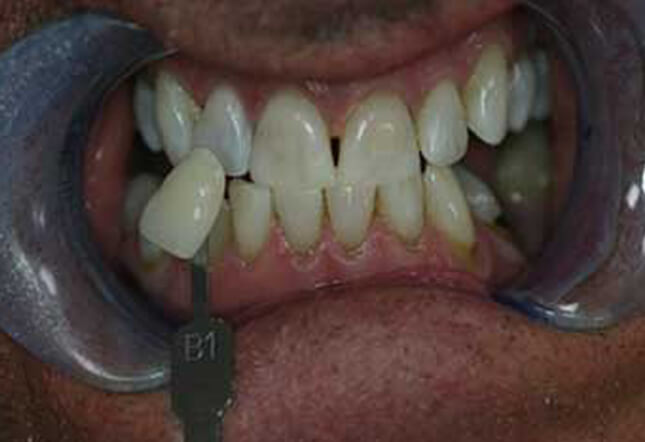 Twenty One dental clinic dentist Brighton Hove
