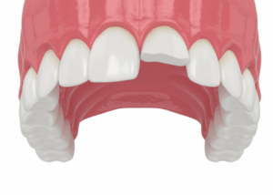 Twenty One dental clinic dentist Brighton Hove