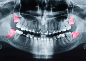 Twenty One dental clinic dentist Brighton Hove