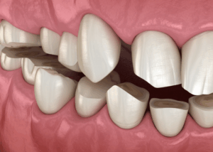 Twenty One dental clinic dentist Brighton Hove