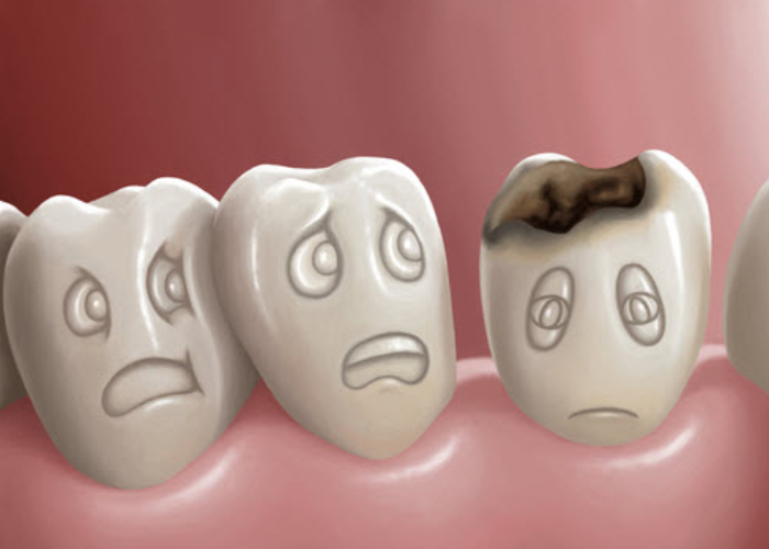 What Causes a Toothache dentist hove Brighton hove