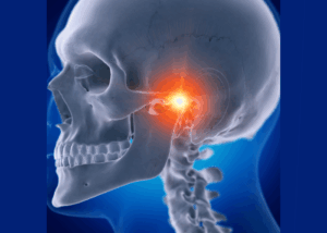 Could You Have TMJ Disorder? Twenty One dental clinic dentist Brighton Hove