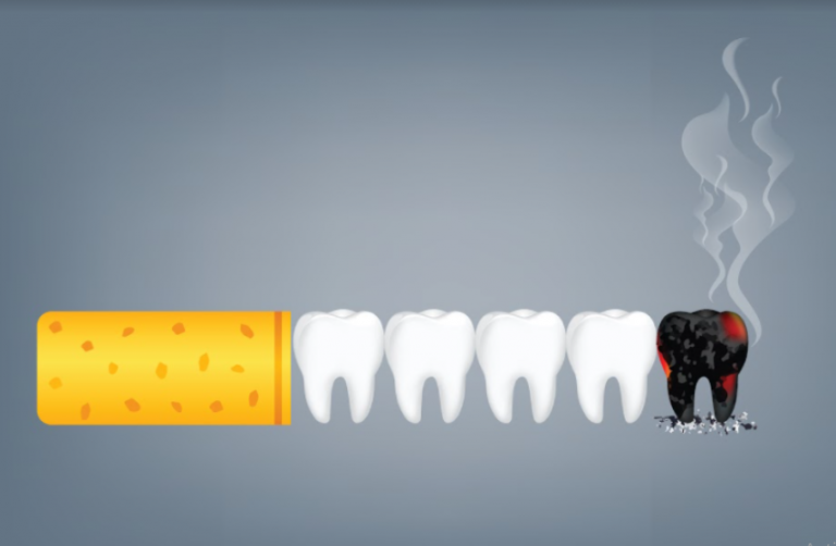 What Are The Risks For Your Teeth And Gums From Smoking? - TwentyOneDental