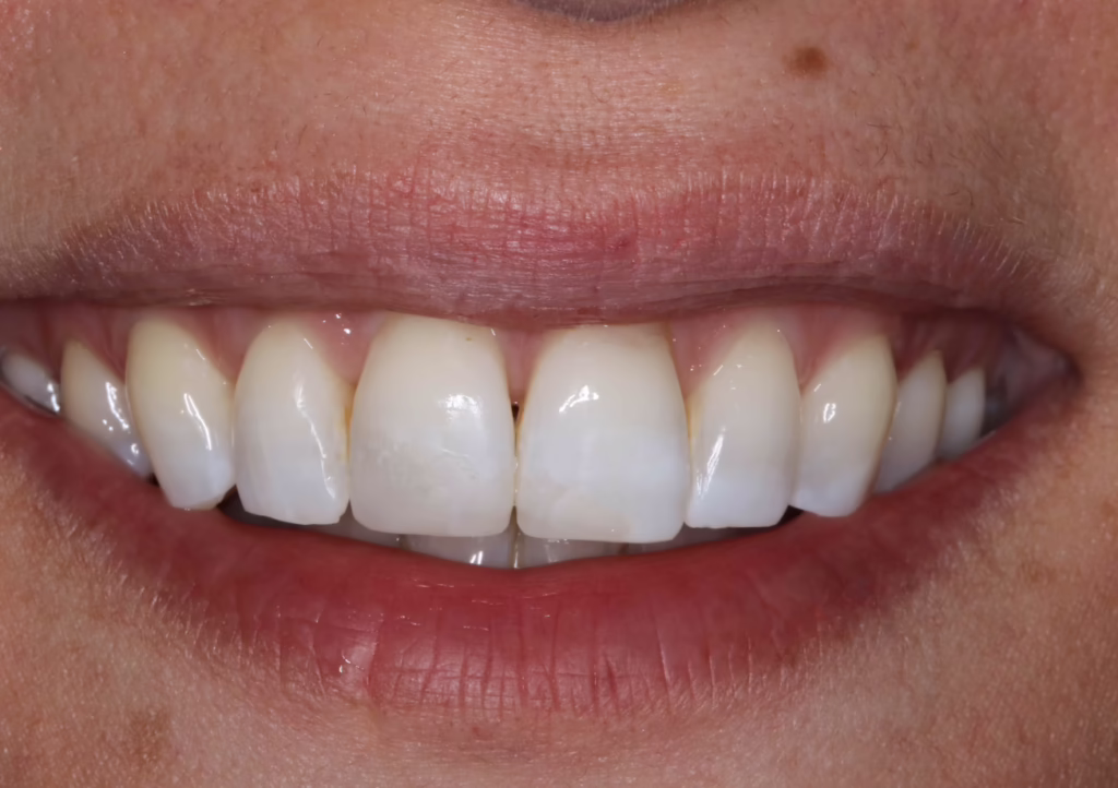 43909425718IMG 0472 converted scaled e1750322284171