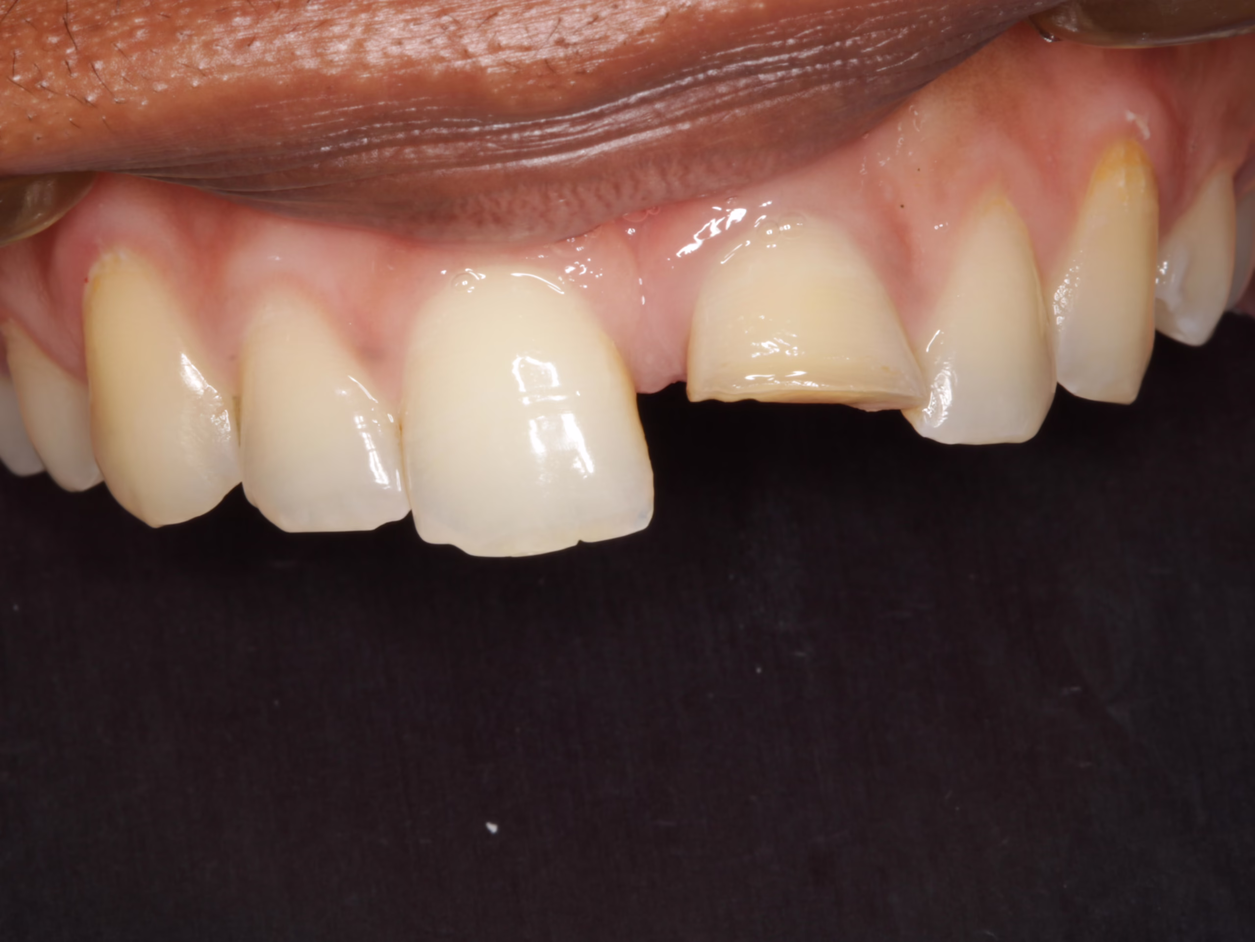 Case 1 before_converted Case 1 before_converted