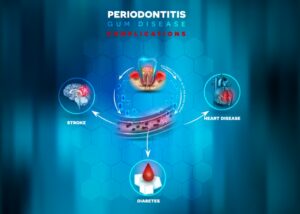 AdobeStock 226850404 700x500 1