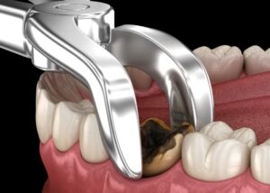 teeth1
