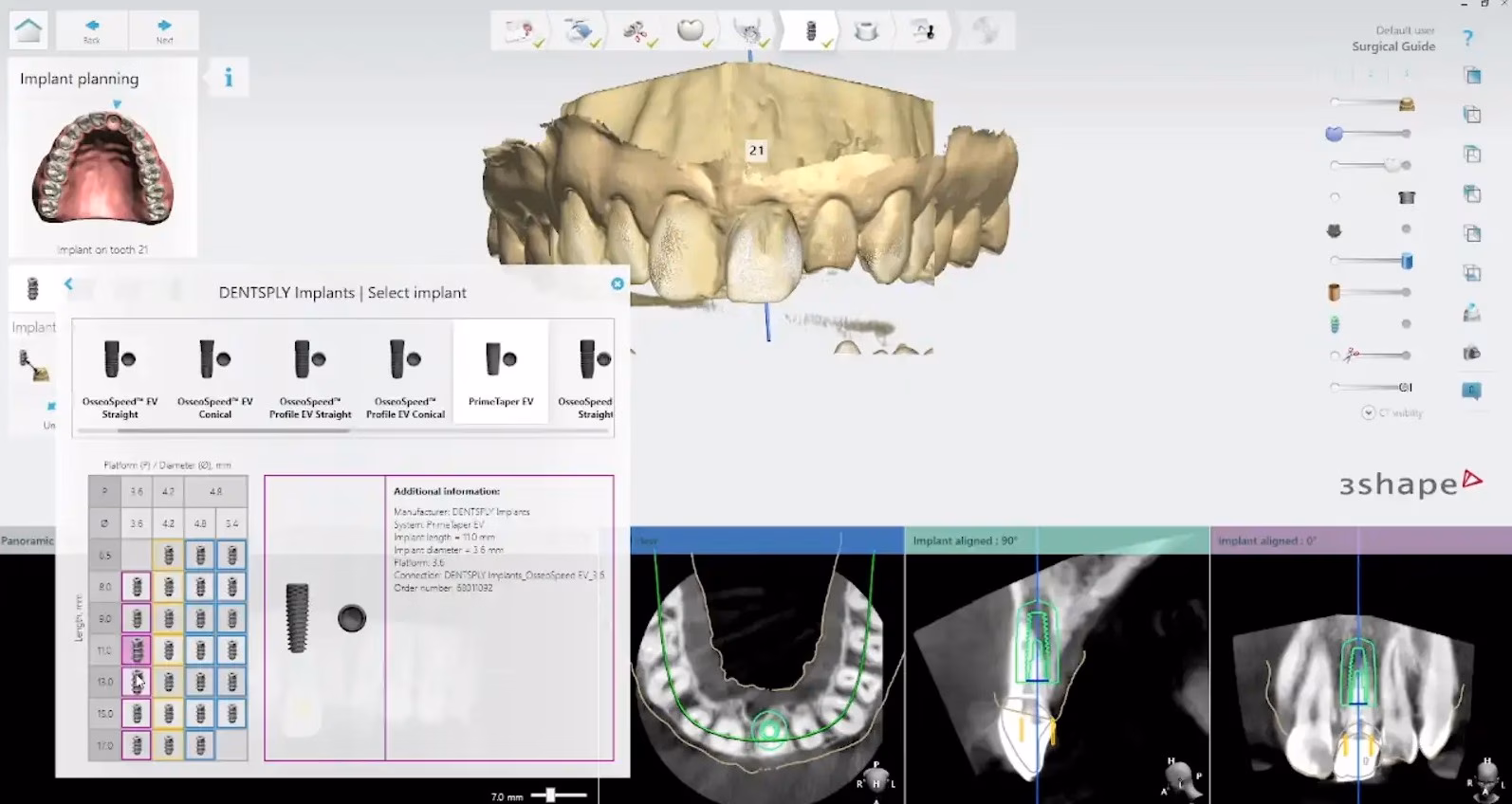 Computerized Implant Planning converted 1