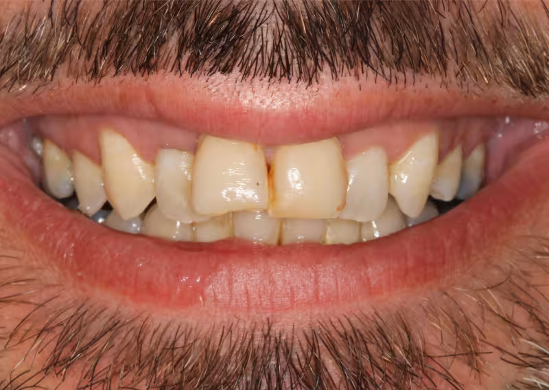 JB Before 1 converted